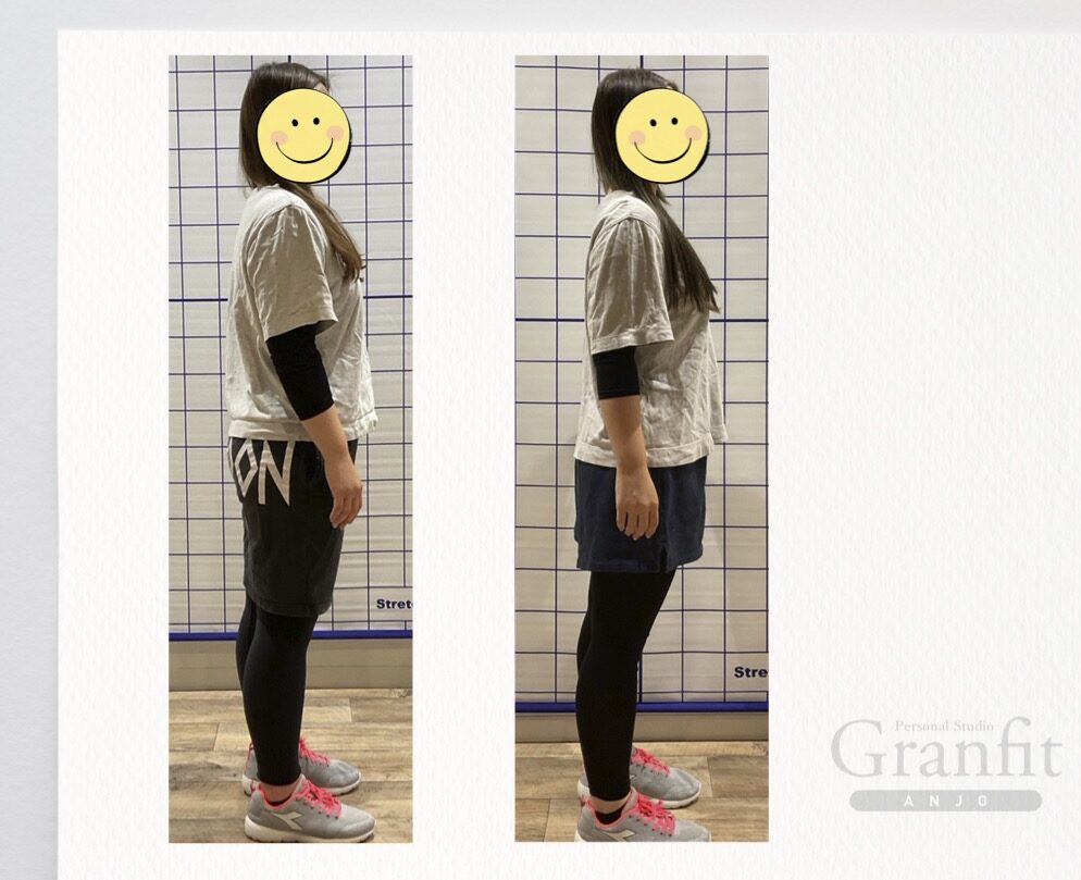 ビフォアフター